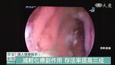 中西合治大腸癌 改善患者生活品質