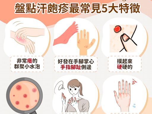 汗皰疹會自己好嗎？擦藥膏凡士林有用嗎？汗皰疹原因治療、初期症狀和香港腳有什麼不同？