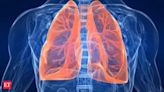 Burden of lung diseases in India likely much higher than Lancet study's projection: Doctors - The Economic Times