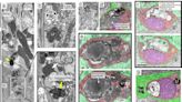 Preclinical model offers new insights into Parkinson's disease process