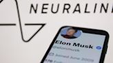 Neuralink brain-chip implant encounters issues in human patient