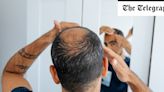 Men on hair-loss drug warned of sexual and psychiatric side effects