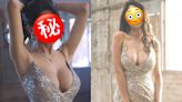 兩年前先隆完胸！網紅揭「想再做1次胸部+修乳暈」無奈揭背後原因