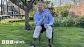 'They looked dead': MP speaks about sepsis limb loss