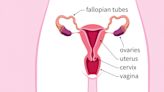 What is ectopic pregnancy? Will abortion bans affect care?