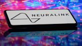 Here's How Neuralink Is Modifying Its Brain Chip for Second Human Patient