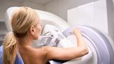 What to Know About Breast Cancer Screening Guidelines