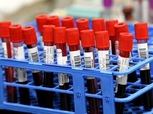 New blood test could help detect Alzheimer’s