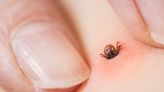 Tick season: What to know about Lyme disease as 'more resilient' ticks this year as parts of Canada see double-digit temperatures