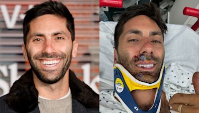 'Catfish' star Nev Schulman says he broke his neck in a collision with a truck: 'C5 and C6 to be exact'