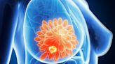 Europe Recommends Three Cancer Drugs