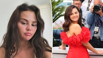 Selena Gomez reveals which cosmetic procedure she’s had done after fan speculation