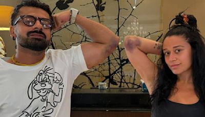 Khatron Ke Khiladi 14: Aashish Mehrotra and Krishna Shroff flaunt their bruises and flex biceps; see PICS