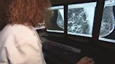 Univ. of Maryland study sheds light on women of color and breast cancer