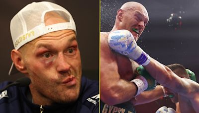 Tyson Fury removed from IBF heavyweight rankings but the reason makes sense