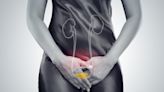 How Bladder Cancer Differs in Women and Younger Adults