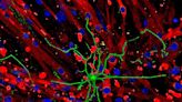 Nerves prompt muscle to release factors that boost brain health, study finds