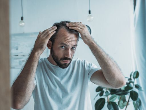 Natural sugar could 'cure' male pattern baldness, scientists suggest