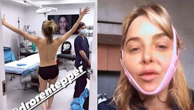 Jenny Mollen Runs Around Topless Before Documenting Breast Lift, Chin Liposuction and Fat Transfer