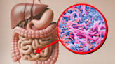 Infusión que protege la microbiota intestinal