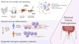 Mount Sinai Researchers the First to Apply Single-Cell Analysis to Reveal Mechanisms of a Common Complication of Crohn’s Disease