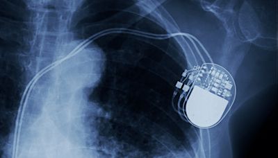 Abbott gains CE approval for dual-chamber leadless pacemaker