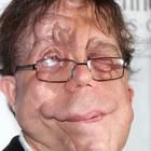 Adam Pearson