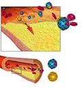 Arteriosclerosis