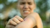 Why this fast-acting insect bite and sting zapper deserves a place in your medicine cabinet