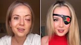 Young Woman's Stroke Misdiagnosed as Anxiety Attack. Months Later, She Loses Sight in One Eye (Exclusive)
