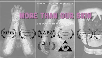 ‘More Than Our Skin’ makes Minnesota premiere June 25 in St. Louis Park