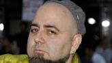 Food Network’s Duff Goldman Injured In Car Crash, Blames Drunk Driver