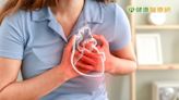 30歲少婦產後心肌病變瀕死關頭 人工心臟救回一命