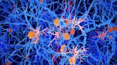 The truth about the new class of Alzheimer’s drugs