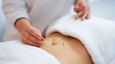 Can Acupuncture Boost Your Sex Drive? Here's What An Expert Has To Say