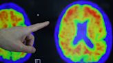 Exclusive-US to build $300 million database to fuel Alzheimer's research