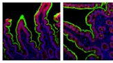 Estudio revela que pacientes con COVID-19 prolongado tienen más probabilidades de padecer problemas gastrointestinales