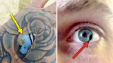 My Mind Was Actually Blown When I Saw These 49 Examples Of Genetic Abnormalities, Injuries, And Other Wild Photos Of The...