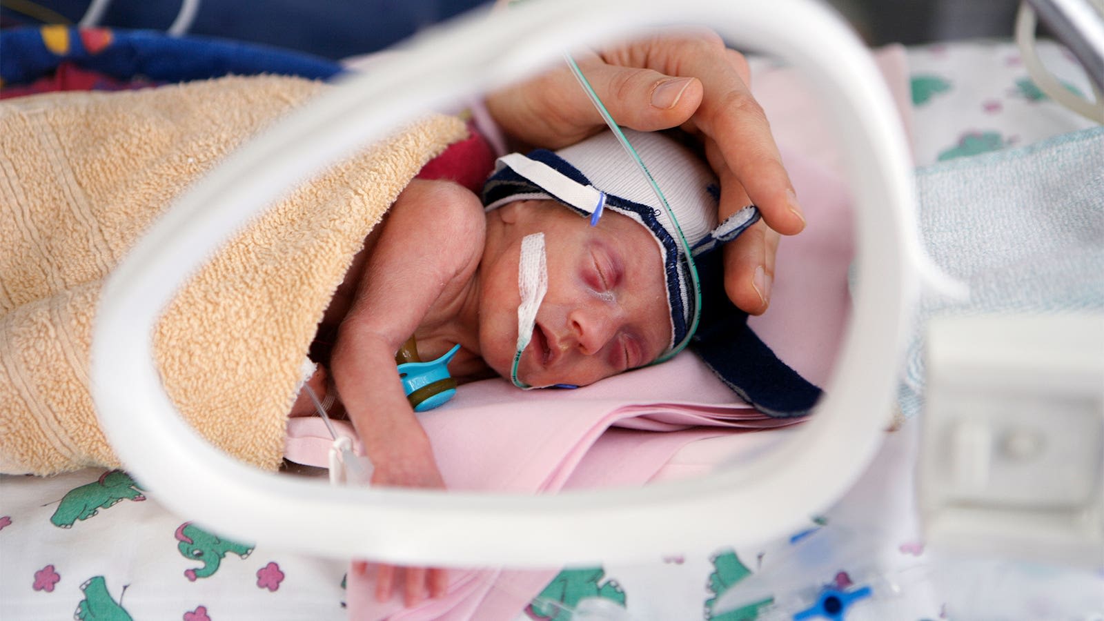 Antibiotic Overuse in Preemies' Early Life Tied to Higher Risk of BPD, Death