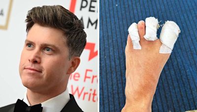 Colin Jost suffers staph infection after Olympics surfing injury: "This might ruin my WikiFeet score"