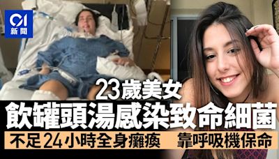 女子飲罐頭湯感染致命細菌中毒 不足24小時全身癱瘓靠呼吸機吊命