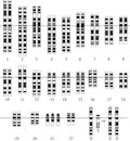 Chromosome abnormality