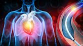Checkliste - Kardiologe nennt 7-Schritte-Plan für ein gesundes Herz