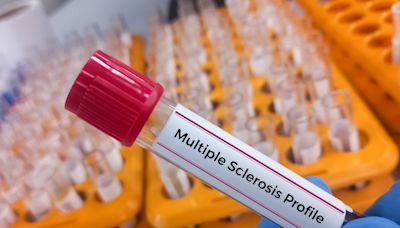 Signs of multiple sclerosis can be detected in blood 5 years before symptoms appear, new study finds. Here's why this breakthrough is important.