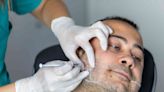 What You Need to Know About Masseter Botox