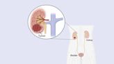 科學家發現對抗常見腎臟癌的新策略