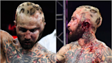 Hematoma alert: Bareknuckle fighter practically grows second head thanks to profuse swelling