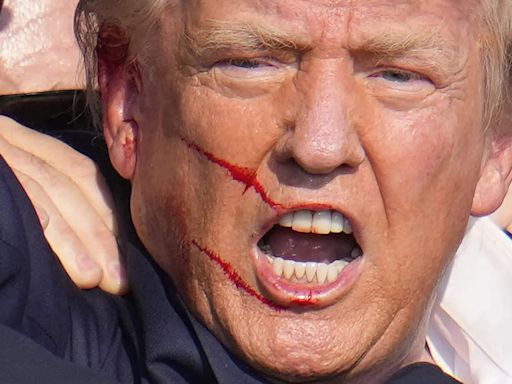 FBI says Trump was indeed struck by bullet during assassination attempt - The Economic Times