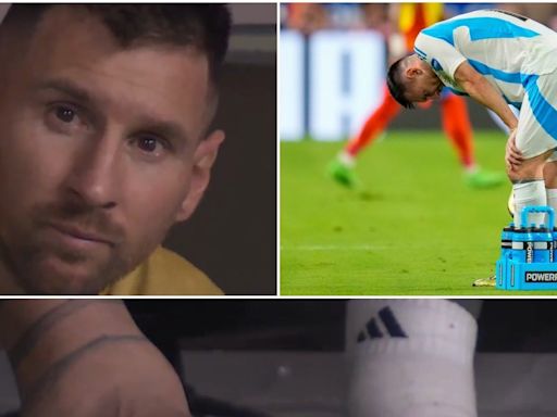 Lionel Messi’s Massive Swollen Ankle Shocks Fans: Argentine’s Ankle Looks Like a Balloon in Copa America Final Video - News18
