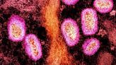 CDC data highlight urban impact of mpox, US cities most at risk of resurgence